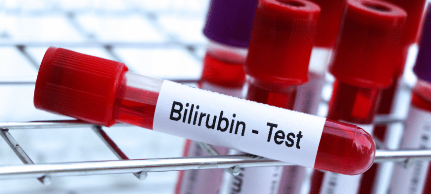 Bilirubin Düzeyleri ve Sağlıklı Yaşam Süreci