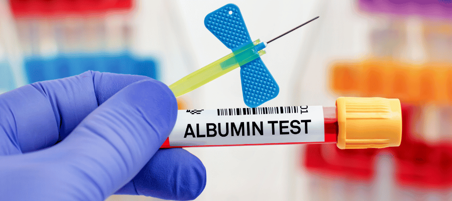 Albümin Yüksekliği ve Düşüklüğü Belirtileri Nelerdir? 