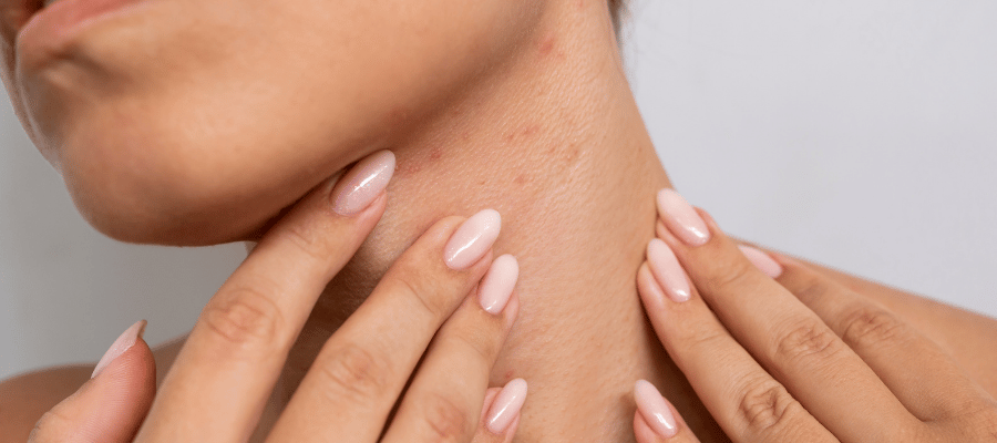 İsilik Belirtileri Nelerdir?