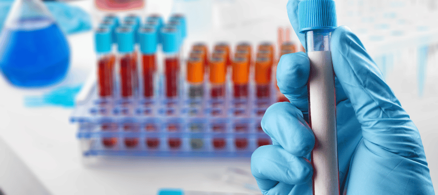 PSA testi, prostat hastalıklarını erken dönemde tespit etmek ve riskleri değerlendirmek amacıyla yapılır.