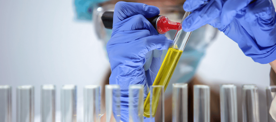 Bilirubin Yüksekliği Tedavi Yöntemleri Nelerdir?