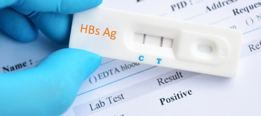 Anti-HBs Seviyeleri Longevity (Uzun ve Sağlıklı Yaşam) Açısından Ne Anlama Gelir?