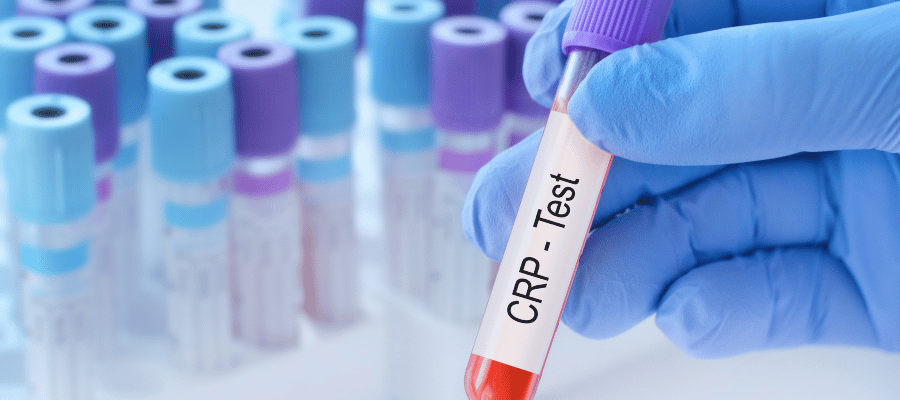 CRP düzeyi sağlıklı bireylerde genellikle düşük seyreder ve çoğu laboratuvarda 0–5 mg/L aralığı normal kabul edilir.