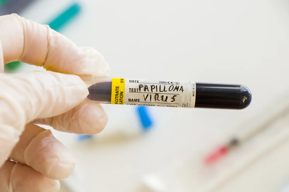 HPV Vücuttan Atılır Mı? HPV Hakkında Bilmeniz Gerekenler