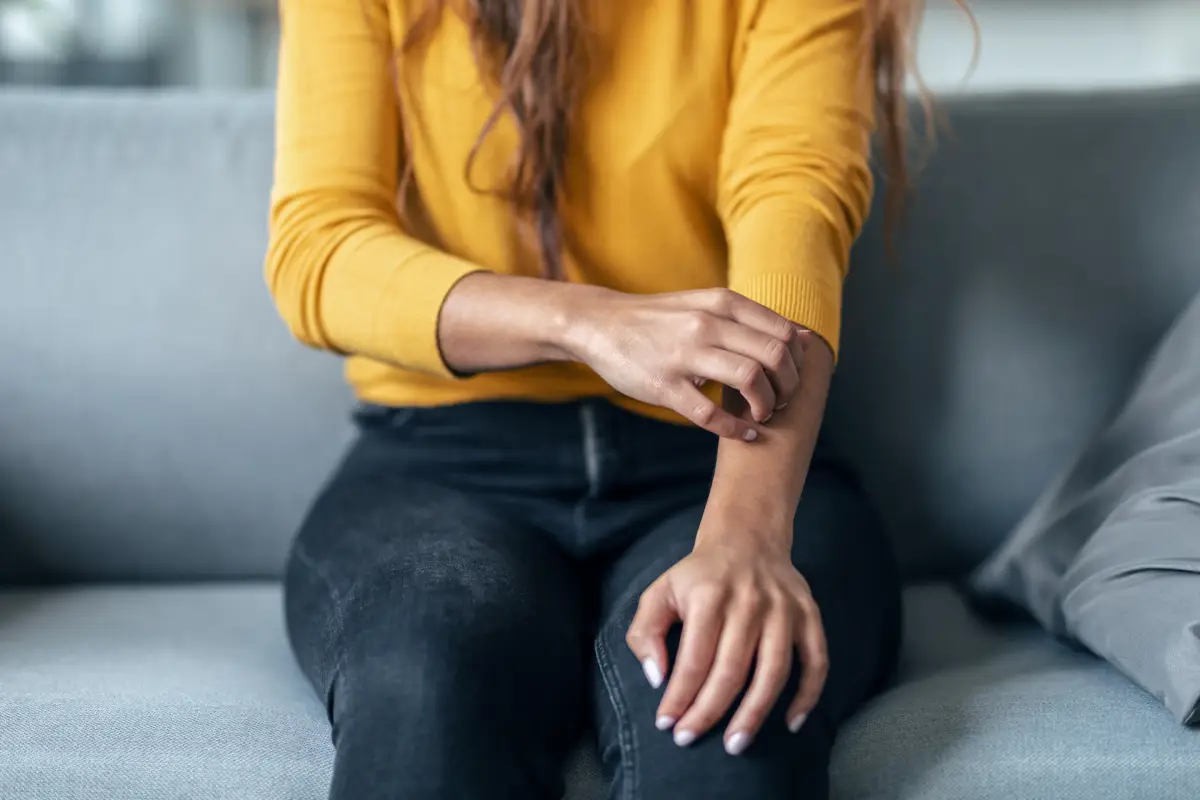 Strese Bağlı Egzama Nedir? Belirtileri Nelerdir?