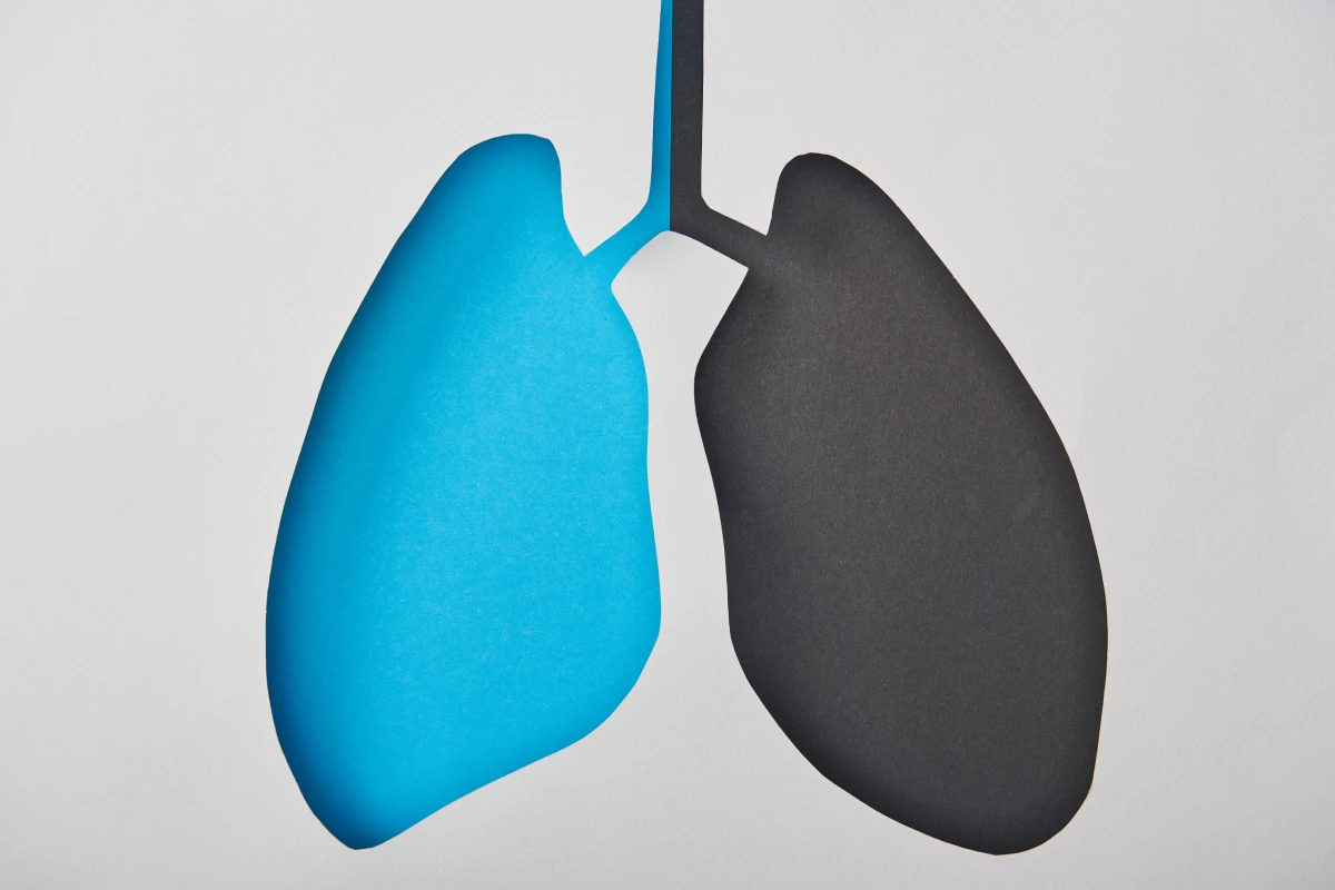 Akciğerde Su Toplanması (Pulmoner Ödem): Nedenleri ve Tedavi Yöntemleri