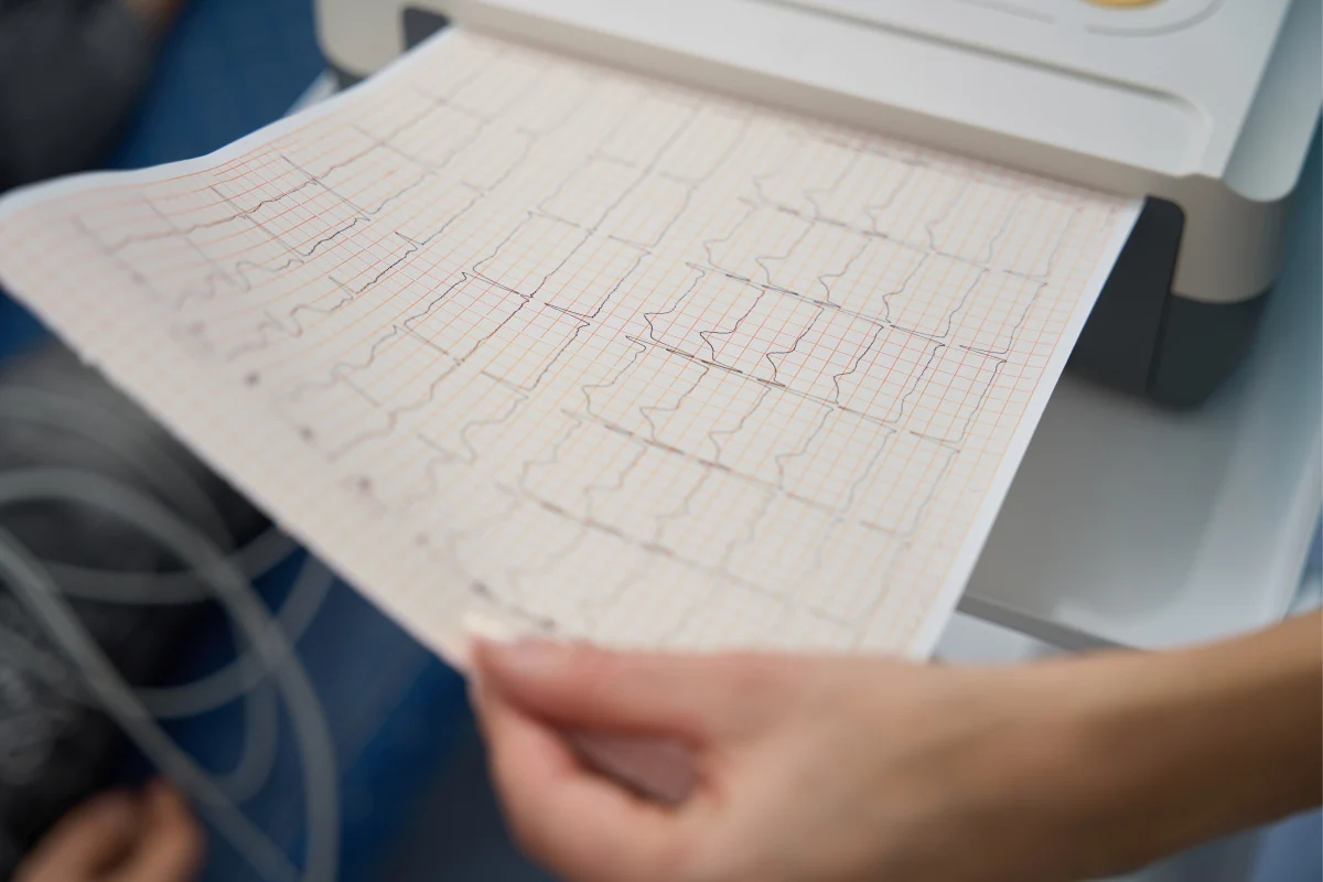 EKG (Elektrokardiyogram): Kalbin Elektriksel Aktivite Ölçümü