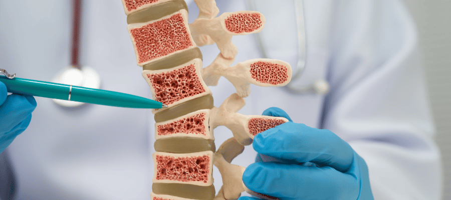 BMD Test Sonuçlarını Anlamak: T-Skoru ve Z-Skoru Ne Anlama Gelir?