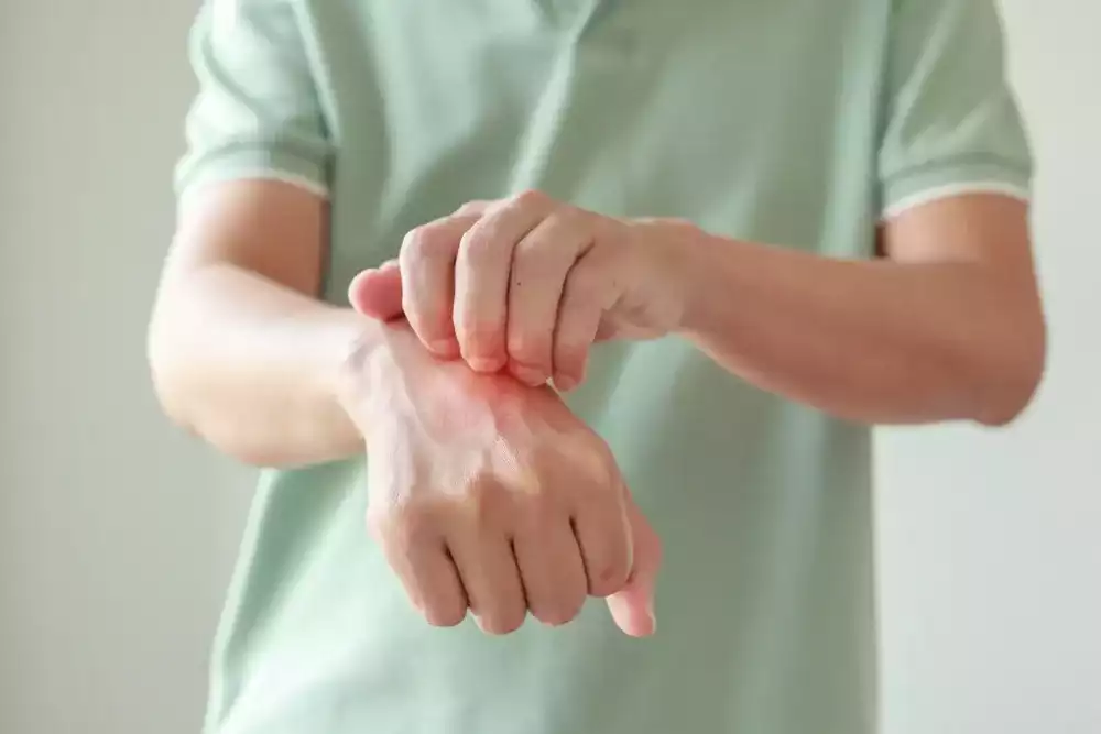 Psoriasis belirtileri