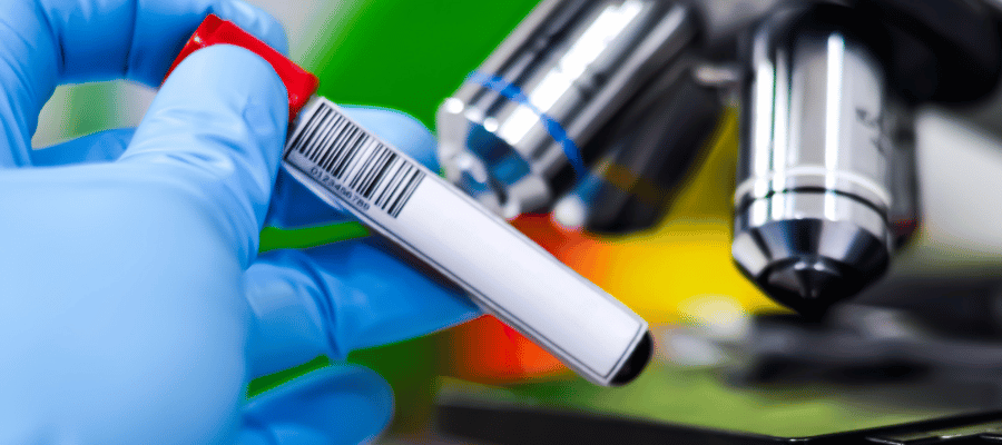 Ailesel hiperkolesterolemi gibi genetik kolesterol bozukluklarında en sık değerlendirilen yapılar LDLR, APOB ve PCSK9 genleridir. Genlerde oluşan mutasyonlar, LDL kolesterolün kandan temizlenme sürecini doğrudan etkileyerek kandaki “kötü kolesterol” düzeyinin kalıcı olarak yüksek kalmasına neden olabilir.