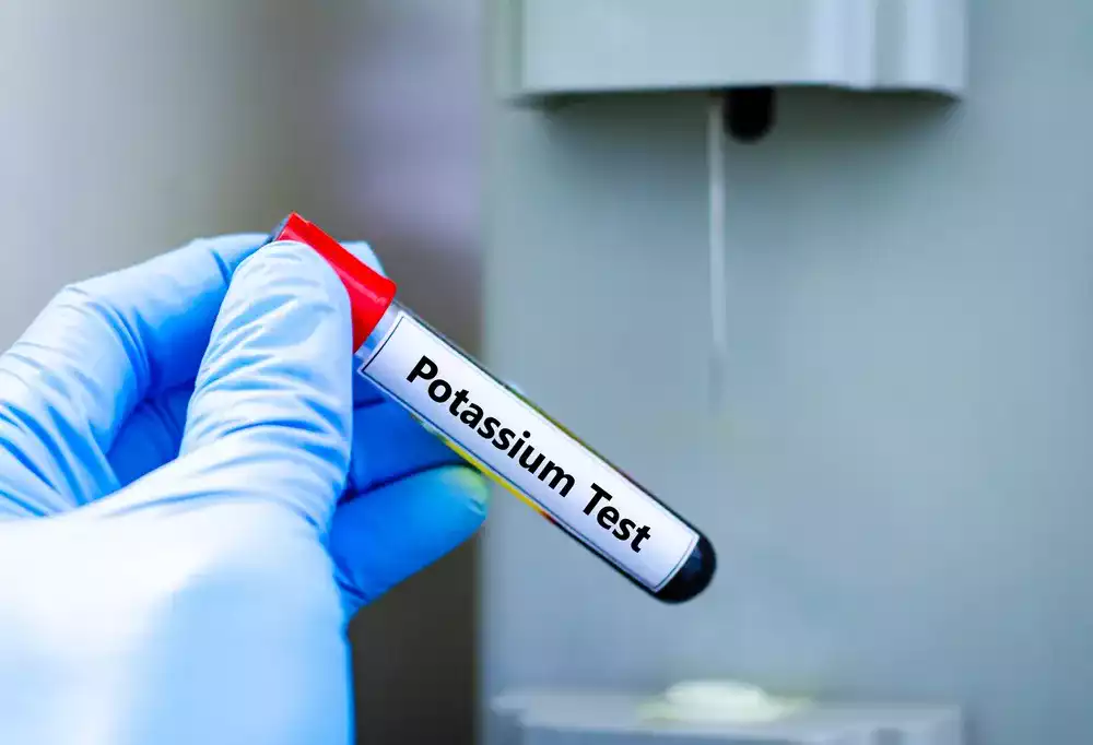 aşırı potasyum alımı